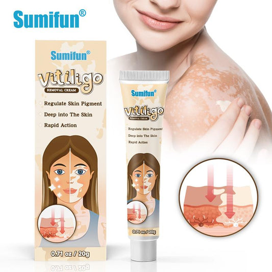 SUMIFUN Vitiligo Treatment Cream | White Spot Care & Antibacterial Herbal Cream for Skin Repair